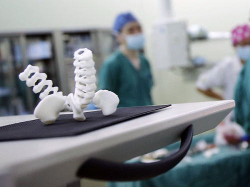 Their anatomy was modeled by 3-D printing technology. The model was used to guide surgeons in the operating room. (China Daily/Yin Liqin) Their anatomy was modeled by 3-D printing technology. The model was used to guide surgeons in the operating room. (China Daily/Yin Liqin)