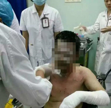 Qin was attacked on Tuesday morning, when a patient poured gasoline on him in a hospital lift and lit it. (Photo/Weibo) Qin was attacked on Tuesday morning, when a patient poured gasoline on him in a hospital lift and lit it. (Photo/Weibo)