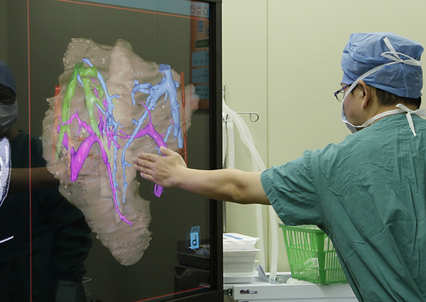 A doctors studies an image on the computer-assisted 3-dimensional system. (Photo/provided to chinadaily.com.cn) A doctors studies an image on the computer-assisted 3-dimensional system. (Photo/provided to chinadaily.com.cn)