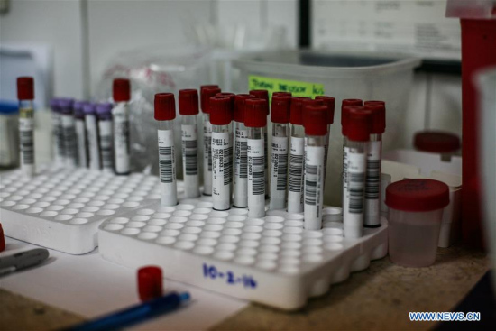 Test tubes are stored at the Salud Chacao Laboratory in Caracas, Venezuela, on Feb. 10, 2016. A total of 31 organizations announced Wednesday that they will share data and results relevant to the current Zika crisis and future public health emergencies as rapidly and openly as possible. (Photo: Xinhua/Boris Vergara) Test tubes are stored at the Salud Chacao Laboratory in Caracas, Venezuela, on Feb. 10, 2016. A total of 31 organizations announced Wednesday that they will share data and results relevant to the current Zika crisis and future public health emergencies as rapidly and openly as possible. (Photo: Xinhua/Boris Vergara)