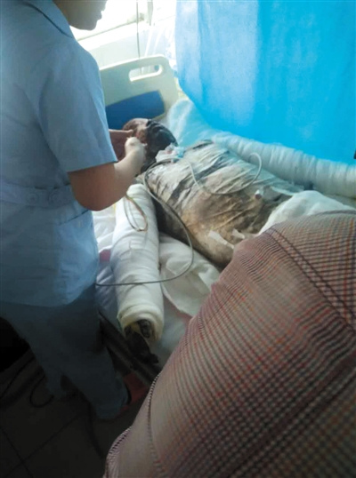 Wang Feng is still not out of danger. (Photo provided by his wife Pan Pin) Wang Feng is still not out of danger. (Photo provided by his wife Pan Pin)