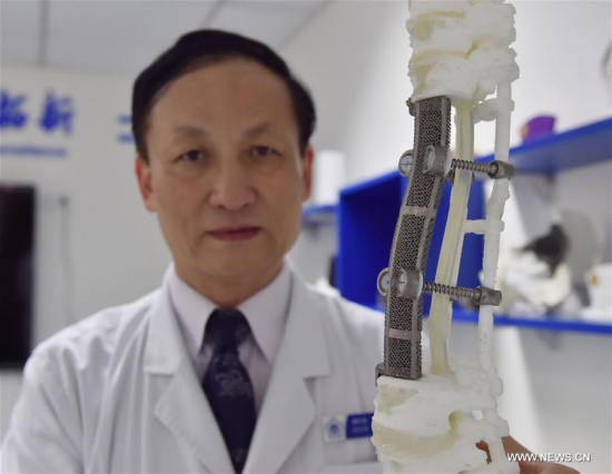 Liu Zhongjun, a surgeon of Peking University Third Hospital, displays a 19-centimeter 3D-printed spinal replica in Beijing, capital of China, July 19, 2016. (Xinhua/Li Wen) Liu Zhongjun, a surgeon of Peking University Third Hospital, displays a 19-centimeter 3D-printed spinal replica in Beijing, capital of China, July 19, 2016. (Xinhua/Li Wen)