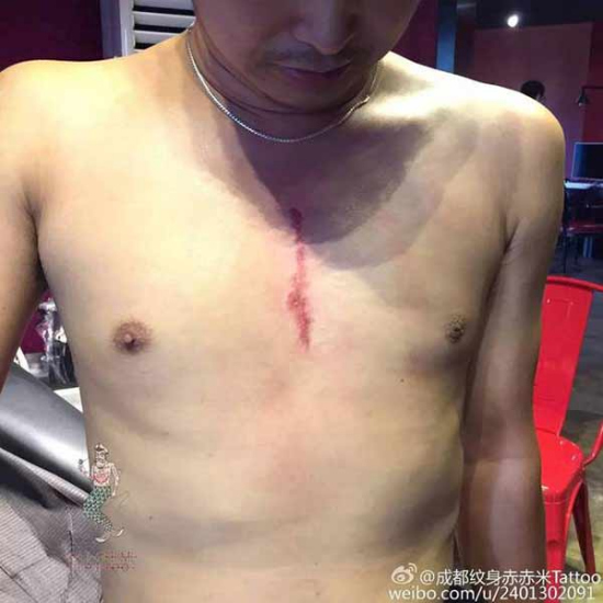 The scar-shaped tattoo. (Photo from Sina Weibo) The scar-shaped tattoo. (Photo from Sina Weibo)