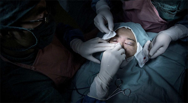 Millions of people in China -predominantly women - have had surgery in pursuit of beautiful looks. Feng Haiyong / For China Daily Millions of people in China -predominantly women - have had surgery in pursuit of beautiful looks. Feng Haiyong / For China Daily