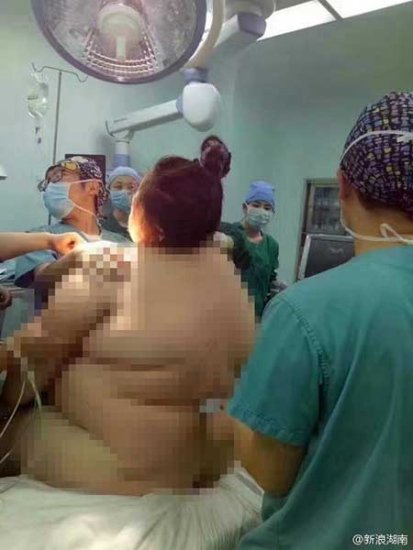 Medical staff members help the woman deliver the baby. (Photo from Sina Weibo) Medical staff members help the woman deliver the baby. (Photo from Sina Weibo)