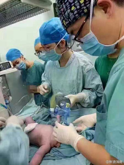 Medical staff members take care of the newborn. (Photo from Sina Weibo) Medical staff members take care of the newborn. (Photo from Sina Weibo)