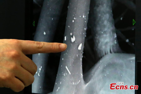 Professor Liu Yong from Beijing University of Chemical Technology shows the smog particles on used masks through an electron microscope on Jan 3, 2017.(Photo: China News Service/Han Haidan) Professor Liu Yong from Beijing University of Chemical Technology shows the smog particles on used masks through an electron microscope on Jan 3, 2017.(Photo: China News Service/Han Haidan)