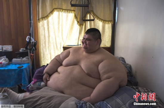 Juan Pedro Franco once weighed more than half a ton at 595 kilos. Juan Pedro Franco once weighed more than half a ton at 595 kilos.
