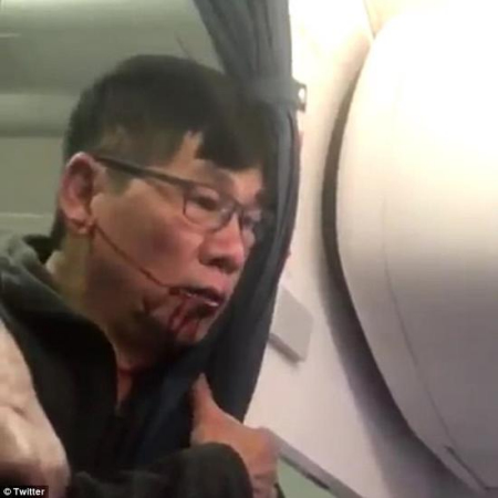 A video screengrab shows passenger David Dao being dragged off a United Airlines flight. A video screengrab shows passenger David Dao being dragged off a United Airlines flight.