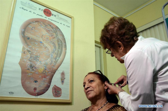 Image taken on March 2, 2017 shows a doctor applying a natural and traditional Chinese medicine treatment on a patient at the Gastroenterology Institute in Havana, Cuba. Over the last 20 years, traditional Chinese medicine (TCM) has been gaining ground in Cuba as a new way of easing ailments and treating chronic pains and diseases. (Xinhua/Joaquin Hernandez) Image taken on March 2, 2017 shows a doctor applying a natural and traditional Chinese medicine treatment on a patient at the Gastroenterology Institute in Havana, Cuba. Over the last 20 years, traditional Chinese medicine (TCM) has been gaining ground in Cuba as a new way of easing ailments and treating chronic pains and diseases. (Xinhua/Joaquin Hernandez)
