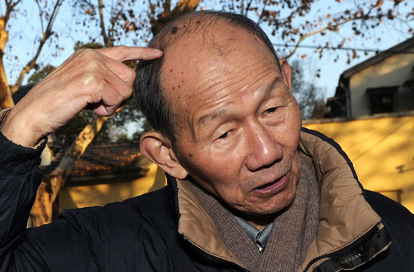 She Ziqing, a survivor of the Nanjing Massacre, recalls being clubbed on the head by a Japanese soldier using a rifle butt. She died on Wednesday at age 83. He was interviewed in 2014.(Photo/Xinhua) She Ziqing, a survivor of the Nanjing Massacre, recalls being clubbed on the head by a Japanese soldier using a rifle butt. She died on Wednesday at age 83. He was interviewed in 2014.(Photo/Xinhua)