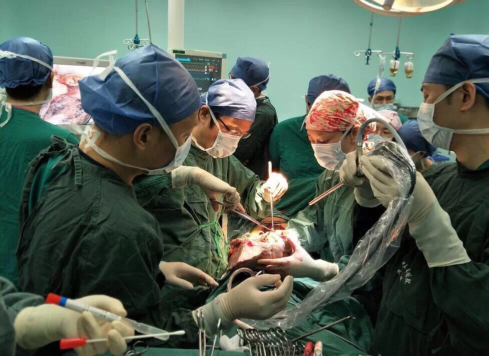 A lung transplant surgery is performed at Wuhan University People’s Hospital after a 12-hour delivery covering 1,200 kilometers. (Photo provided to chinadaily.com.cn) A lung transplant surgery is performed at Wuhan University People’s Hospital after a 12-hour delivery covering 1,200 kilometers. (Photo provided to chinadaily.com.cn)