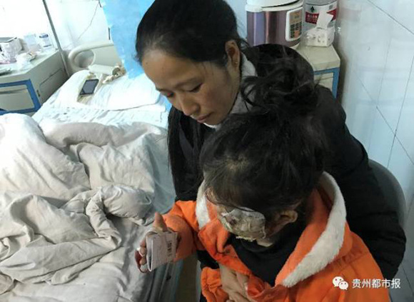 Feng Lingling and her daughter who was burnt in a Samsung Galaxy Note 4 explosion. (Photo/WeChat account of Guizhou Metropolitan Daily) Feng Lingling and her daughter who was burnt in a Samsung Galaxy Note 4 explosion. (Photo/WeChat account of Guizhou Metropolitan Daily)