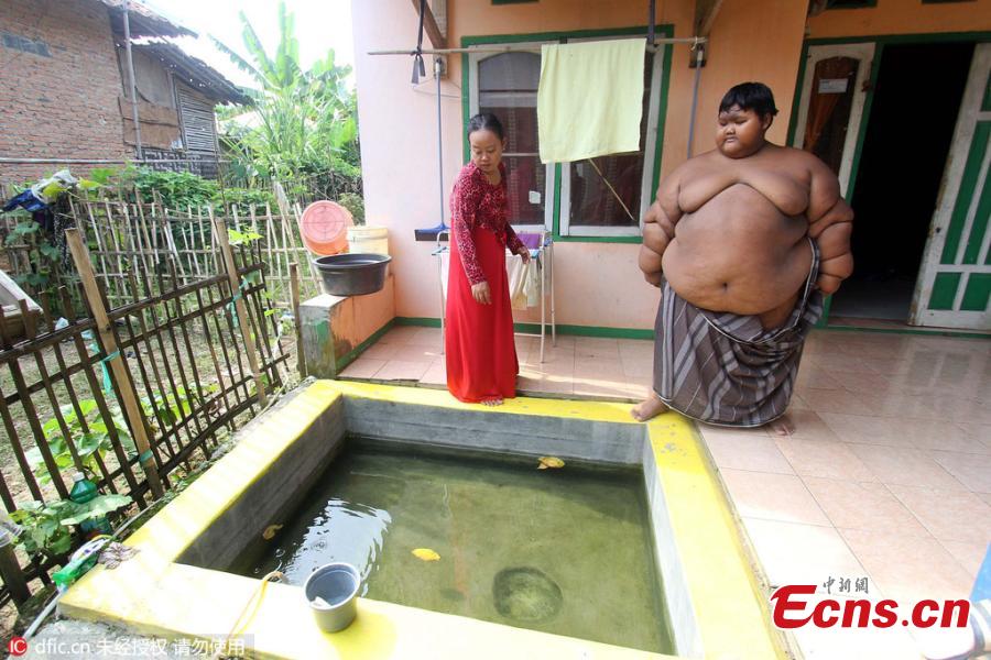 World's fattest child put on crash diet to save life(1/4)