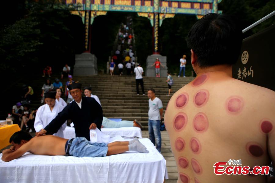 Free cupping therapy at Taoist mountain(1/5)