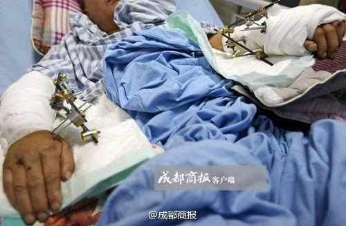 Breeder forgives attacking panda (1/8)