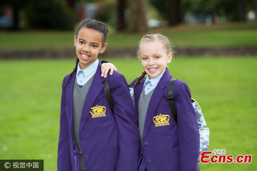 Million-to-one black and white twins to start secondary school(1/4)