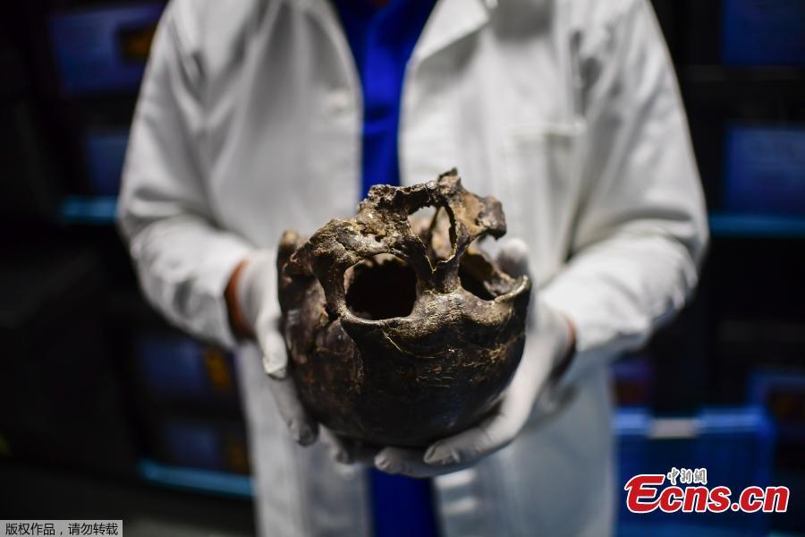 Mexican museum houses over 25,000 skeletons(1/4)