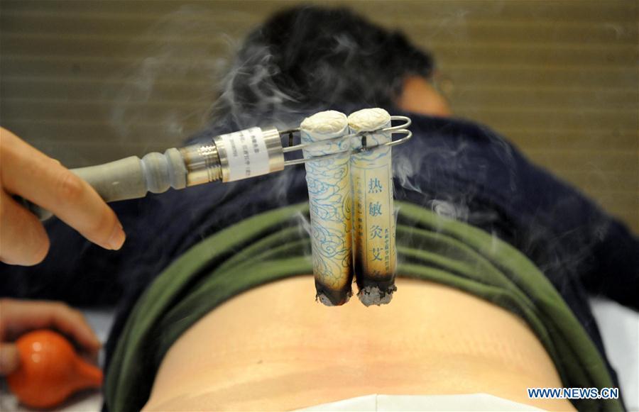 File photo taken on Sept. 29, 2010 shows a tourist experiencing moxibustion treatment at the Expo Park in Shanghai, east China. Traditional Chinese medicine (TCM), one of the world\'s oldest forms of medicine with different practices including acupuncture, bee-sting therapy, cupping, moxibustion, scrapping, tuinaing, tui na (Chinese therapeutic massage), still prevails in the modern society after thousands of years of evolution, during which generations have restored and maintained health depending on it. The World Health Organization disease index was updated to include references to traditional Chinese medicine for the first time in June 2018. (Photo/Xinhua)