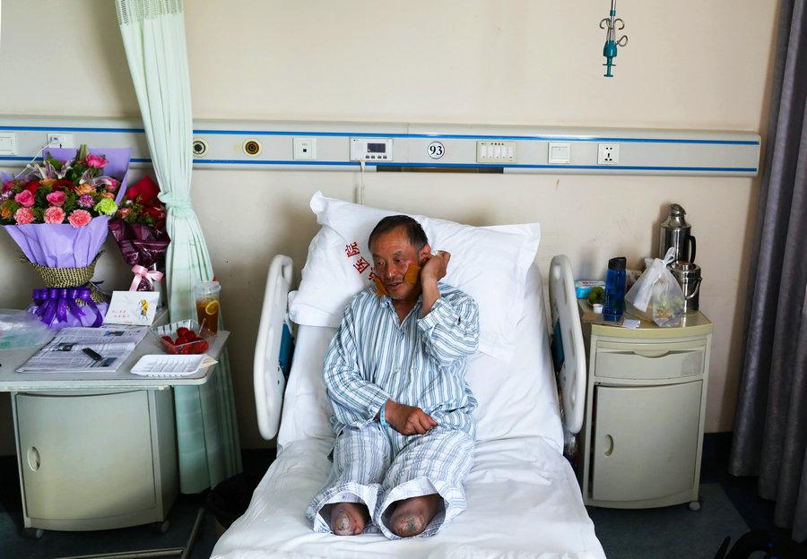 Xia receives treatment in a hospital for his frostbitten face and fingers. (Photo/China Daily)

In 2014 and 2015, respectively, he was at the base camp of the south slope of Qomolangma in Nepal, but could not proceed due to an avalanche and an earthquake.

Later, in 2016, Xia tried to climb the mountain for the fourth time. But when he was less than 100 meters from the summit, a snowstorm blocked his way.