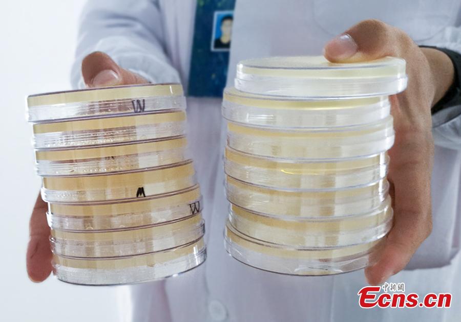 Patterns formed with bacteria are shown in petri dishes during a microbial art competition at China Pharmaceutical University in Nanjing, East China’s Jiangsu province. Students of the school have created artworks by placing various strains of bacteria like staphylococcus and colibacillus into petri dishes, and letting the microbes react and spread across carefully drawn patterns.  (Photo: China News Service/ Jiang Chen)