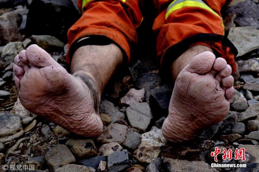 A firefighter takes off his shoes and reveals the condition of his feet after long immersing in water, Hulunbuir, Inner Mongolia, June 4, 2018.  (Photo/Agencies)