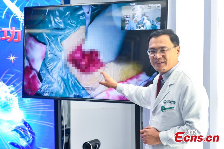 Doctor Qi Yong at the Second People\'s Hospital in Guangdong Province supervises a surgery at Yanshan Hospital through a 4K UHD live broadcast via 5G, April 1, 2019. (Photo: China News Service/Zhong Xin)